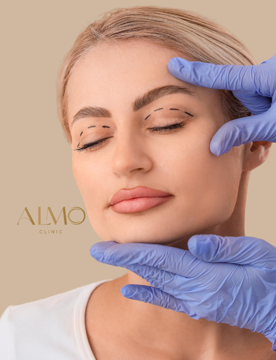 Blefaroplastia Bogotá — valoración palpebral preoperatoria ALMO Clinic Cirujano plástico certificado evaluando párpados para blefaroplastia en Bogotá — ALMO Clinic