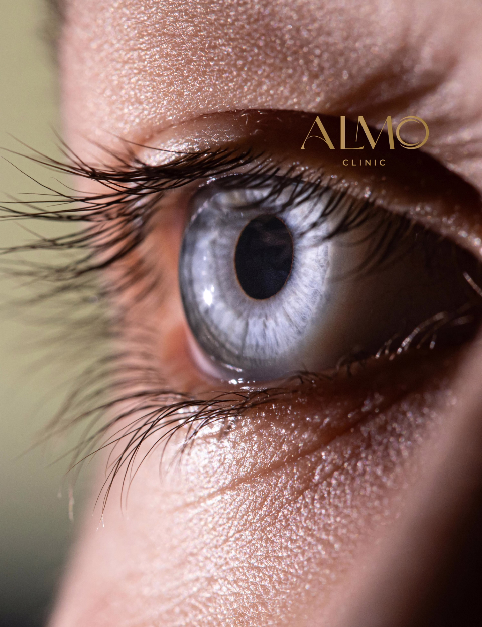 Blefaroplastia láser CO2 Bogotá — técnica quirúrgica de precisión milimétrica Blefaroplastia con láser CO2 en Bogotá — técnica de incisión en pliegue palpebral para resultado natural ALMO Clinic