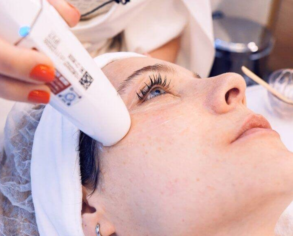 Liftera HIFU para flacidez facial en ALMO Clinic Bogotá
