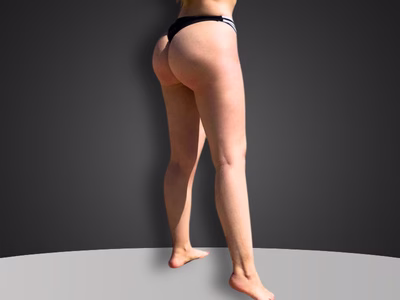 Lifting de muslos (cruroplastia): piel firme en la cara interna del muslo Lifting de muslos cruroplastia ALMO Clinic